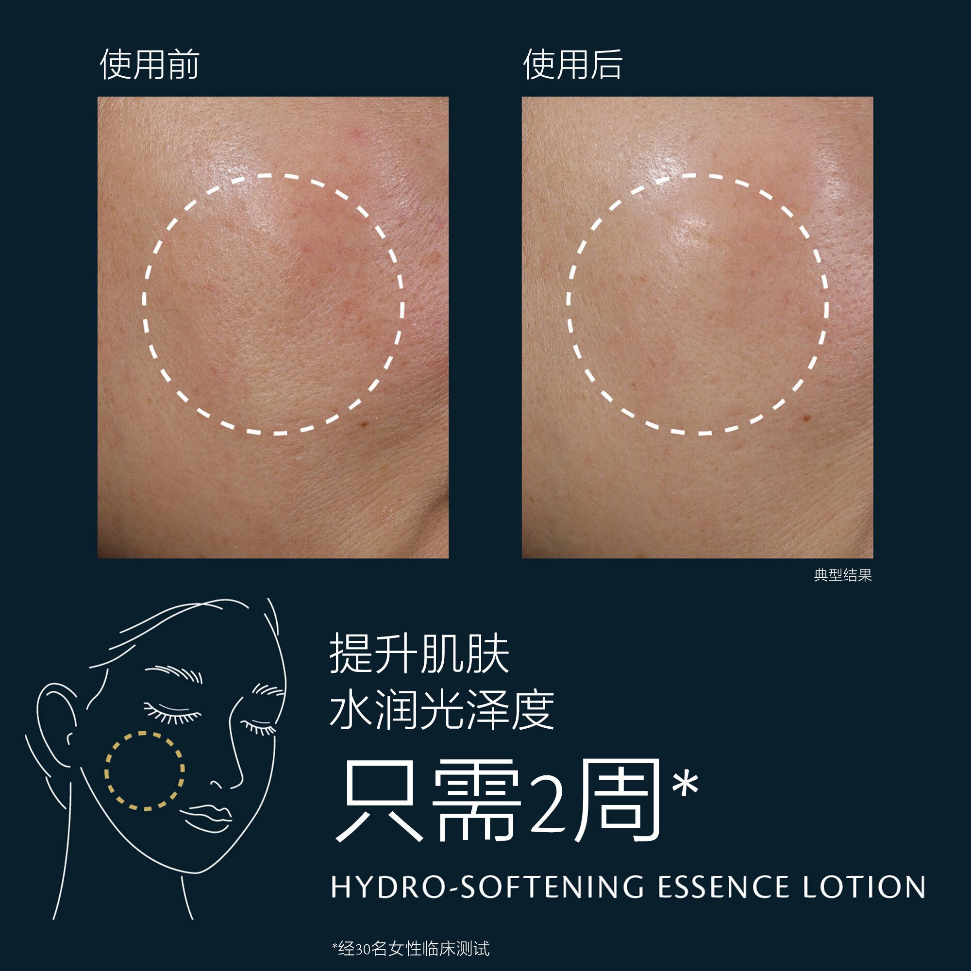 Hydro-Softening Lotion 170ML