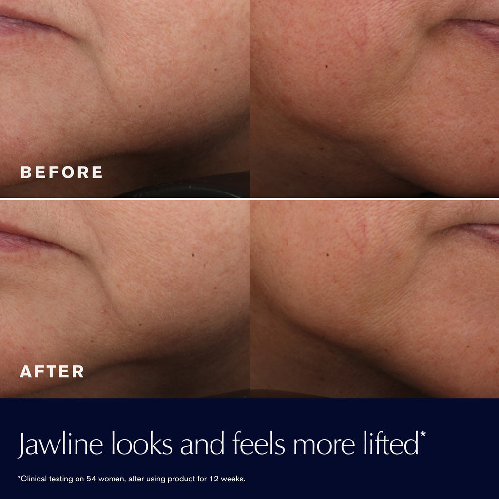 Revitalizing Supreme+ Youth Power Cream