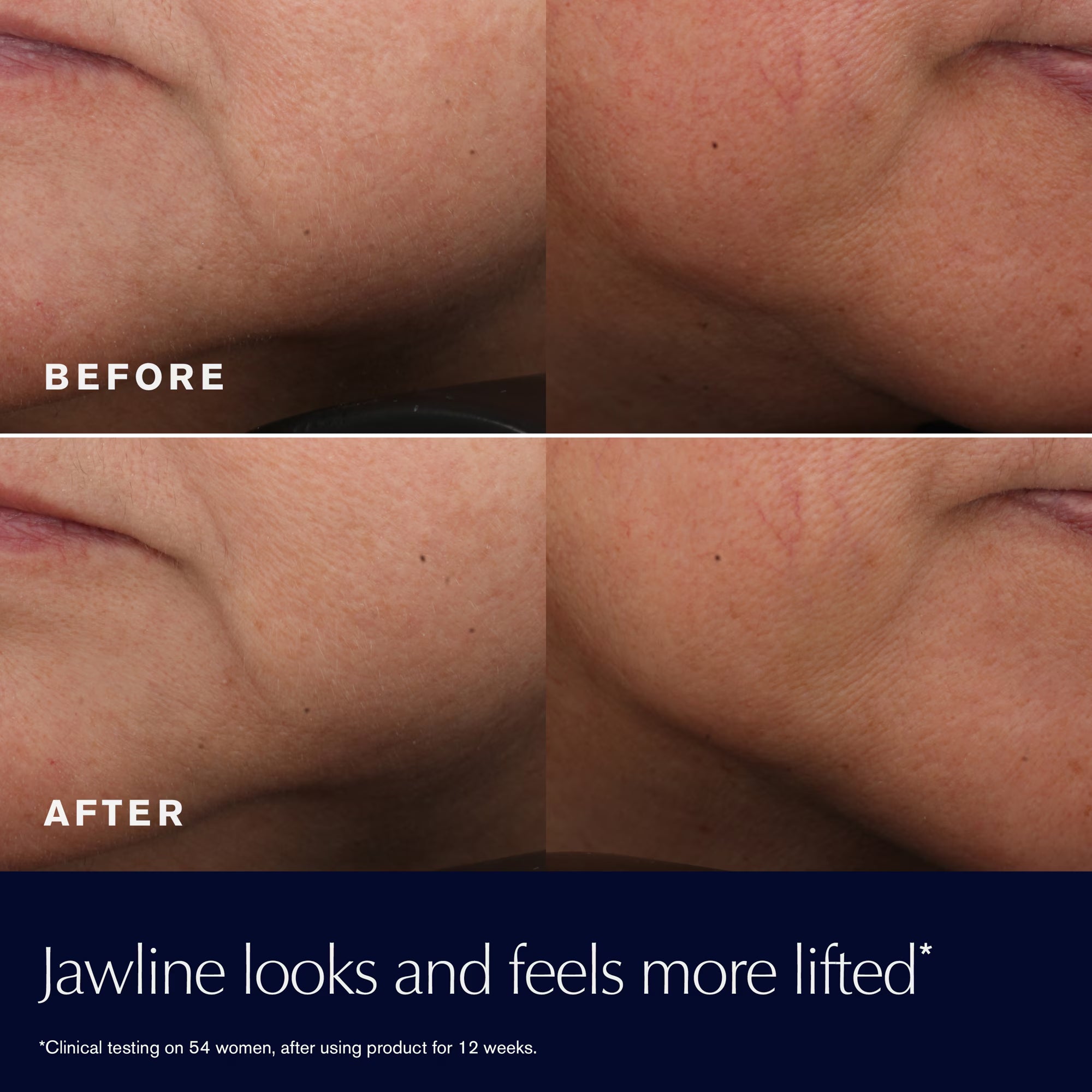 Revitalizing Supreme+ Youth Power Cream